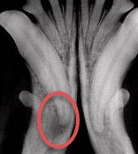 Dental Xray